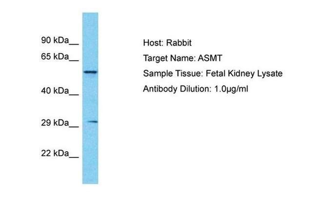 ASMT Antibody in Western Blot (WB)