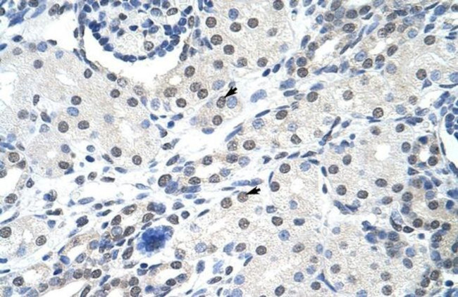SNRPA Antibody in Immunohistochemistry (Paraffin) (IHC (P))