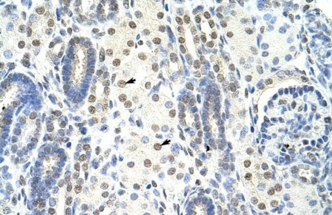 SF1 Antibody in Immunohistochemistry (Paraffin) (IHC (P))