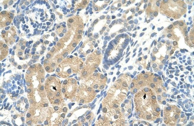 KHK Antibody in Immunohistochemistry (Paraffin) (IHC (P))