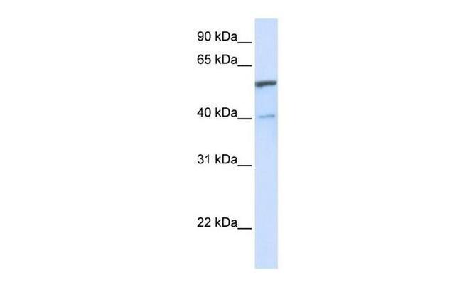 UGT1A6 Antibody in Western Blot (WB)