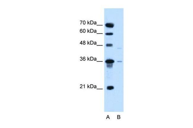 SLC17A3 Antibody in Western Blot (WB)