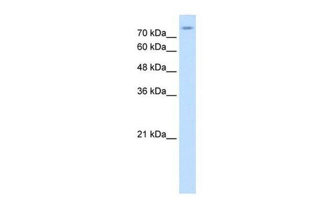 SLC20A2 Antibody in Western Blot (WB)