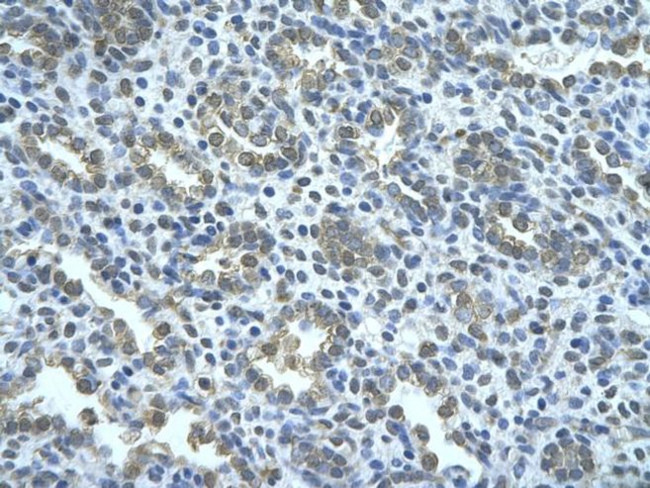 AIP2 Antibody in Immunohistochemistry (Paraffin) (IHC (P))