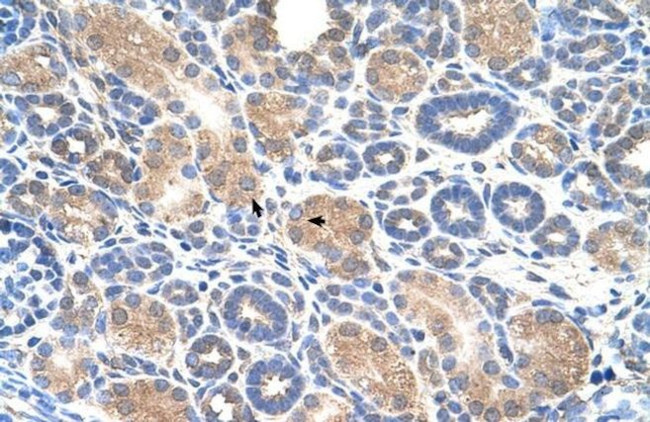 AIP2 Antibody in Immunohistochemistry (Paraffin) (IHC (P))