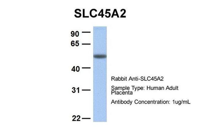 SLC45A2 Antibody in Western Blot (WB)