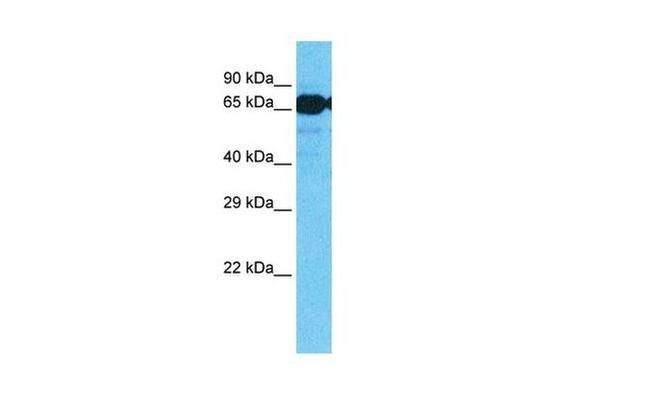 SLC7A8 Antibody in Western Blot (WB)