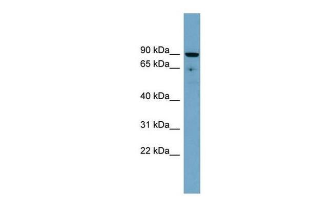 SLC26A9 Antibody in Western Blot (WB)