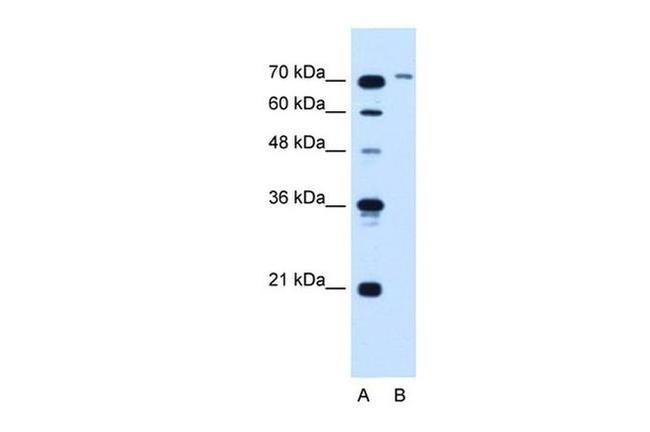 SLCO6A1 Antibody in Western Blot (WB)