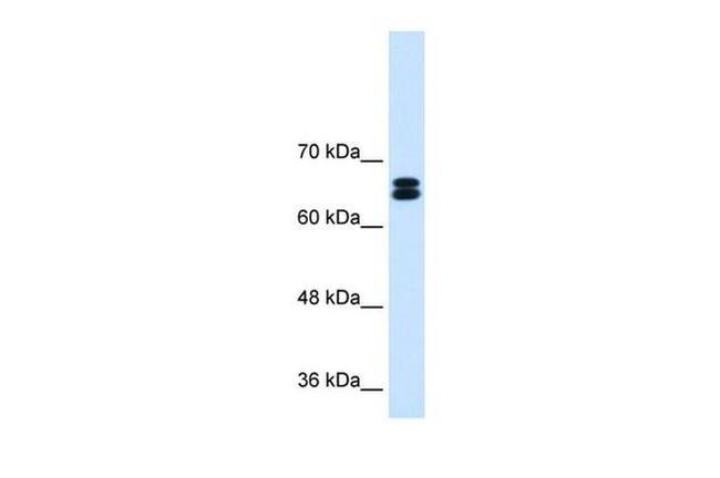 SLC9A9 Antibody in Western Blot (WB)