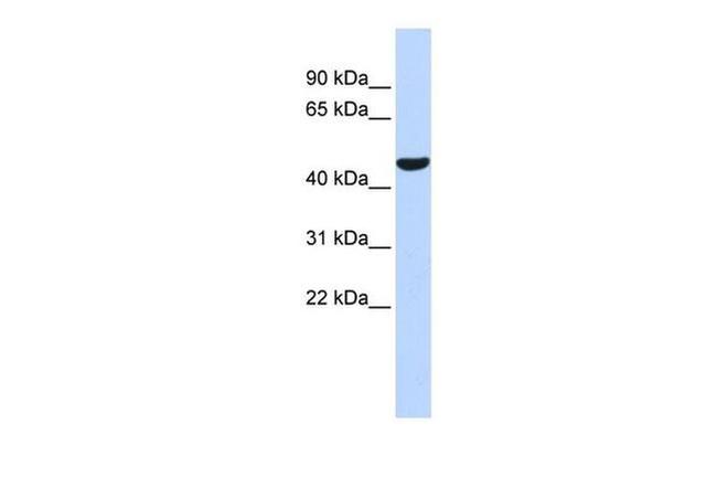 PTGIS Antibody in Western Blot (WB)