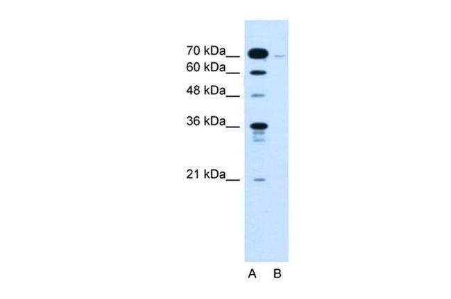KLHL31 Antibody in Western Blot (WB)