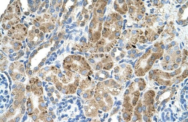 VMA21 Antibody in Immunohistochemistry (IHC)