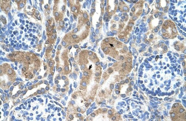 RAP Antibody in Immunohistochemistry (IHC)