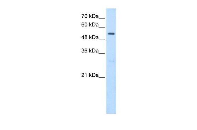 SHMT2 Antibody in Western Blot (WB)