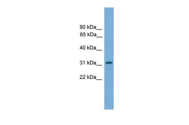 PIGL Antibody in Western Blot (WB)