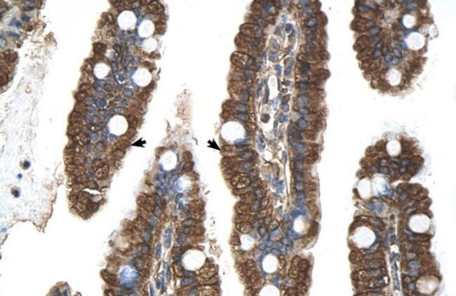 PGRMC1 Antibody in Immunohistochemistry (IHC)