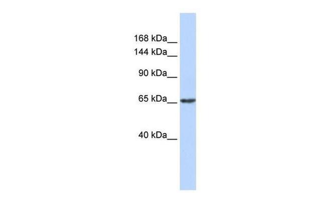 ZNF91 Antibody in Western Blot (WB)