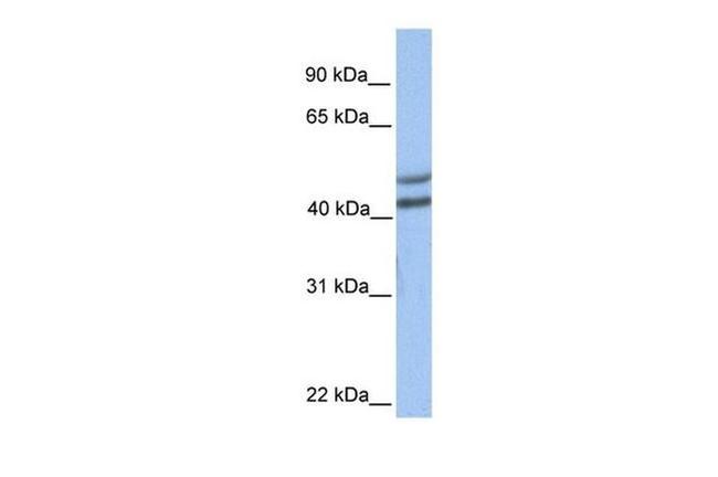 GALT Antibody in Western Blot (WB)