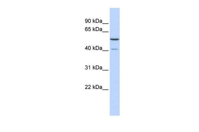 METTL15 Antibody in Western Blot (WB)