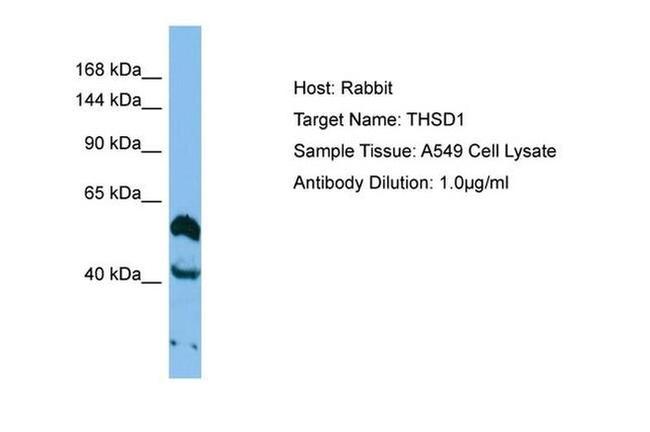 THSD1 Antibody in Western Blot (WB)