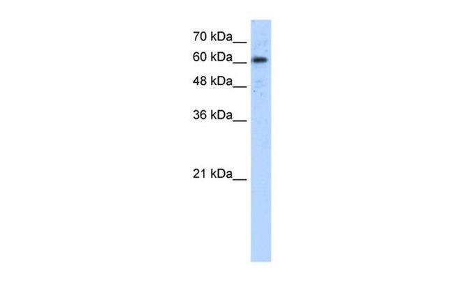 ADAM30 Antibody in Western Blot (WB)