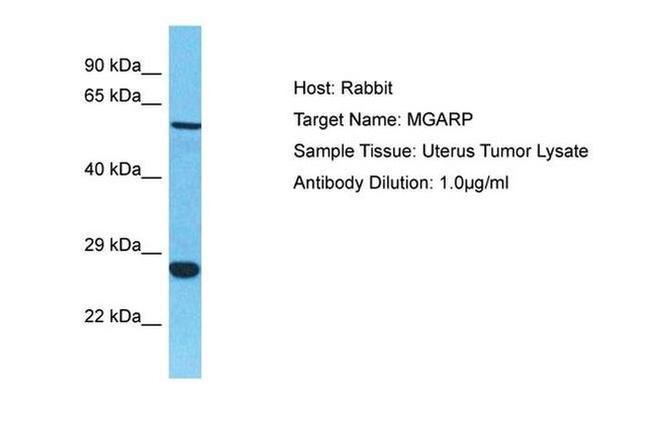 MGARP Antibody in Western Blot (WB)