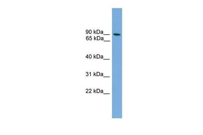 ZNF782 Antibody in Western Blot (WB)