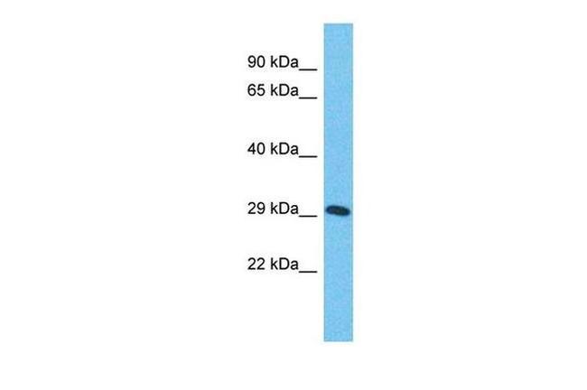 ZNF625 Antibody in Western Blot (WB)