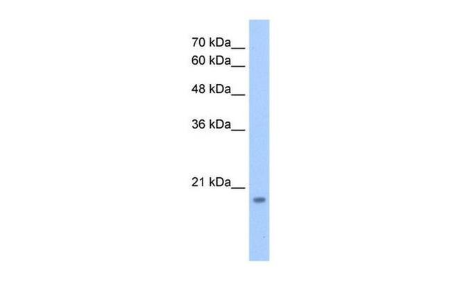 DNTTIP1 Antibody in Western Blot (WB)