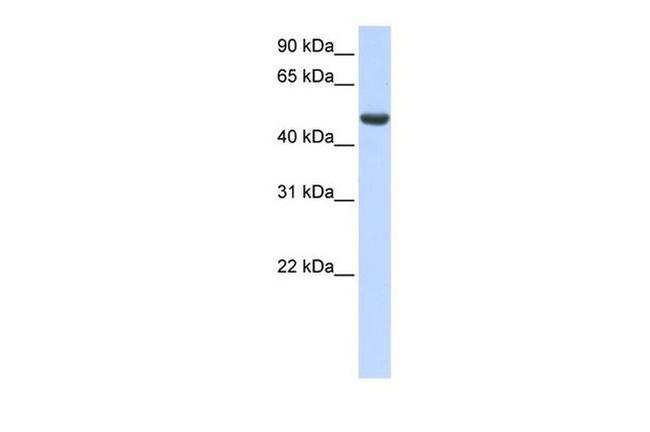 SPATA17 Antibody in Western Blot (WB)