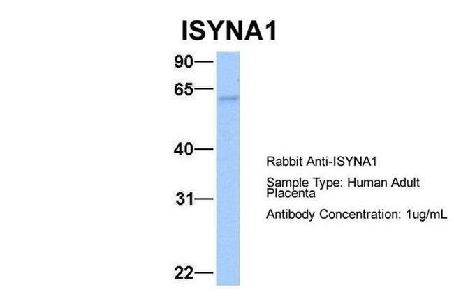 ISYNA1 Antibody in Western Blot (WB)