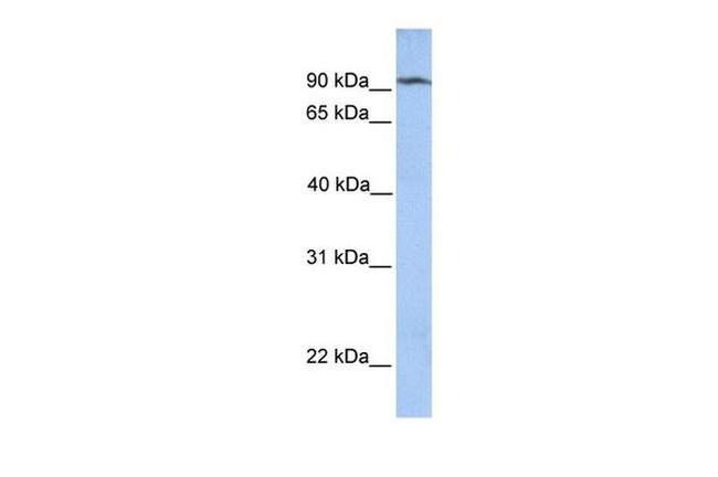 CLPB Antibody in Western Blot (WB)