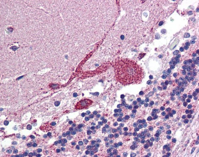 ARF6 Antibody in Immunohistochemistry (Paraffin) (IHC (P))