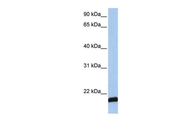 ARF6 Antibody in Western Blot (WB)