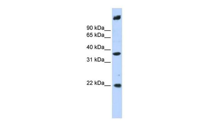 SSBP3 Antibody in Western Blot (WB)