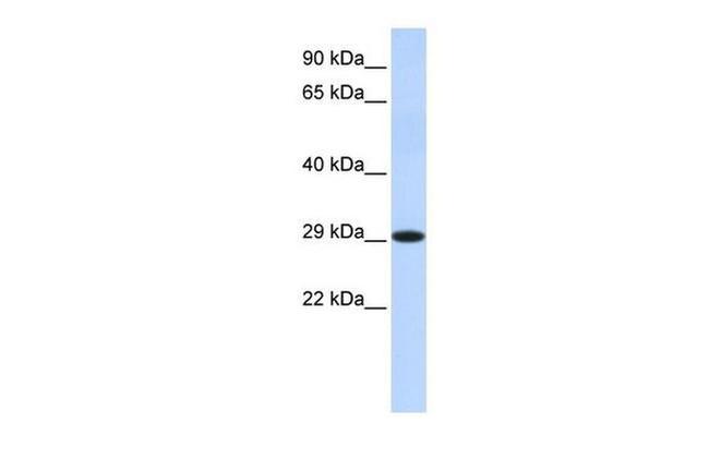 HSD17B14 Antibody in Western Blot (WB)