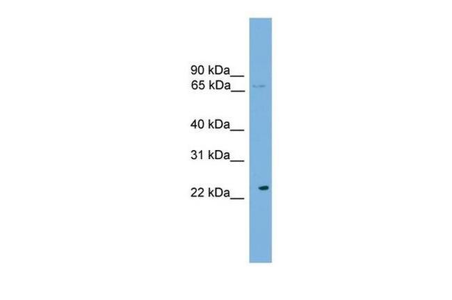 CALCOCO1 Antibody in Western Blot (WB)