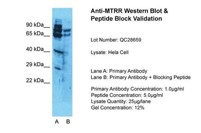 MTRR Antibody in Western Blot (WB)