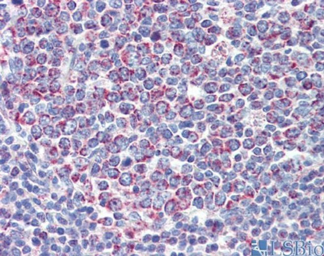 PGLS Antibody in Immunohistochemistry (IHC)