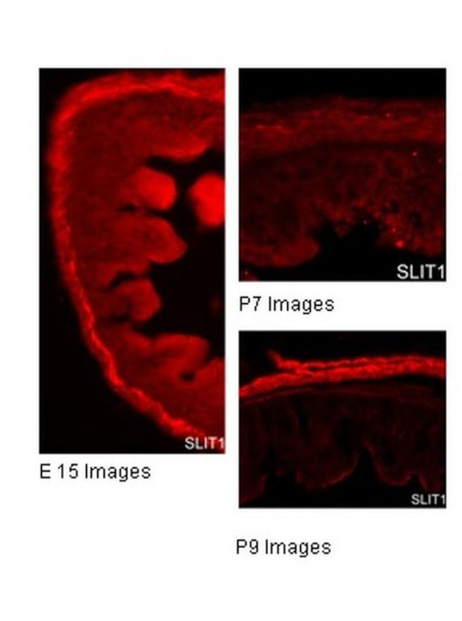 SLIT1 Antibody in Immunohistochemistry (IHC)