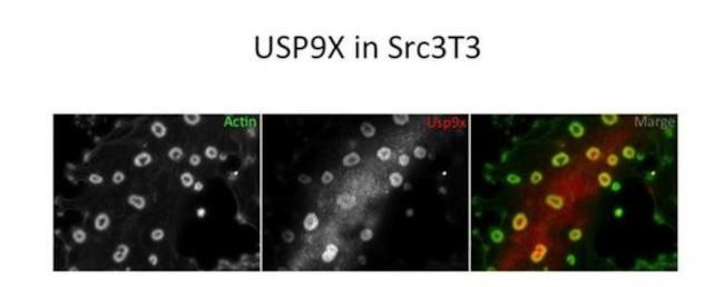 USP9X Antibody in Immunocytochemistry (ICC/IF)