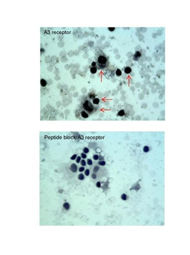 ADORA3 Antibody in Immunohistochemistry (IHC)