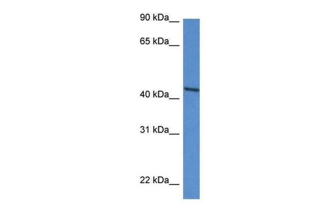 DDO Antibody in Western Blot (WB)