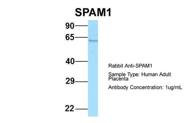 SPAM1 Antibody in Western Blot (WB)