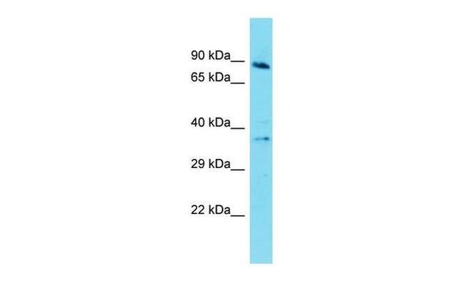 GPR141 Antibody in Western Blot (WB)