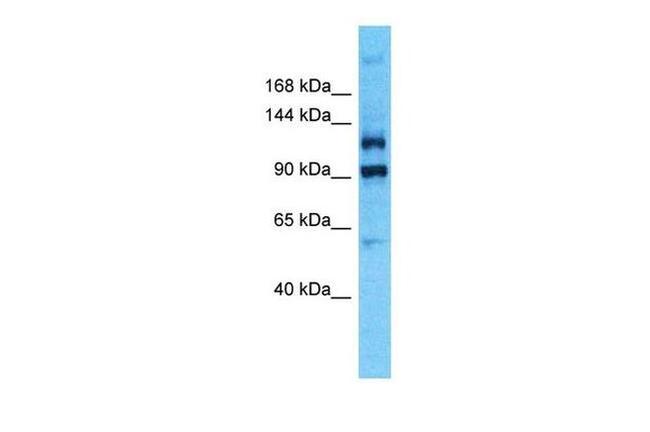 PLEKHG4B Antibody in Western Blot (WB)