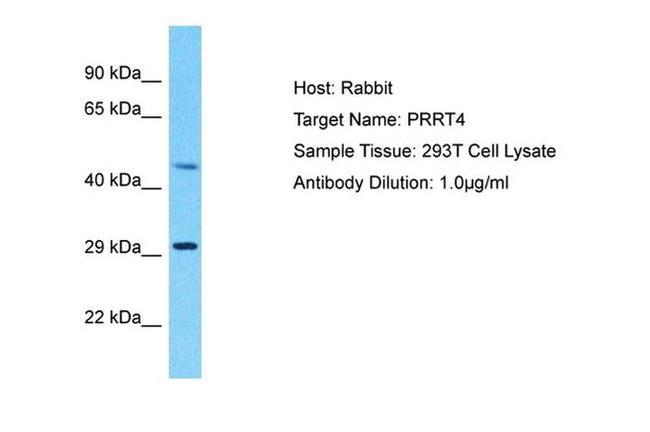 PRRT4 Antibody in Western Blot (WB)