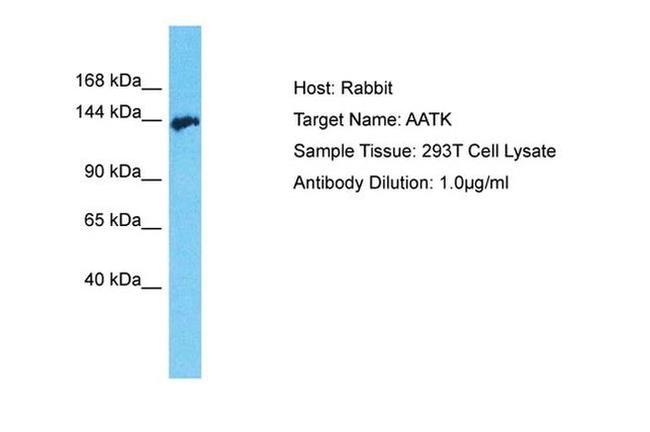 AATK Antibody in Western Blot (WB)