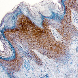 Epiregulin Antibody in Immunohistochemistry (Paraffin) (IHC (P))